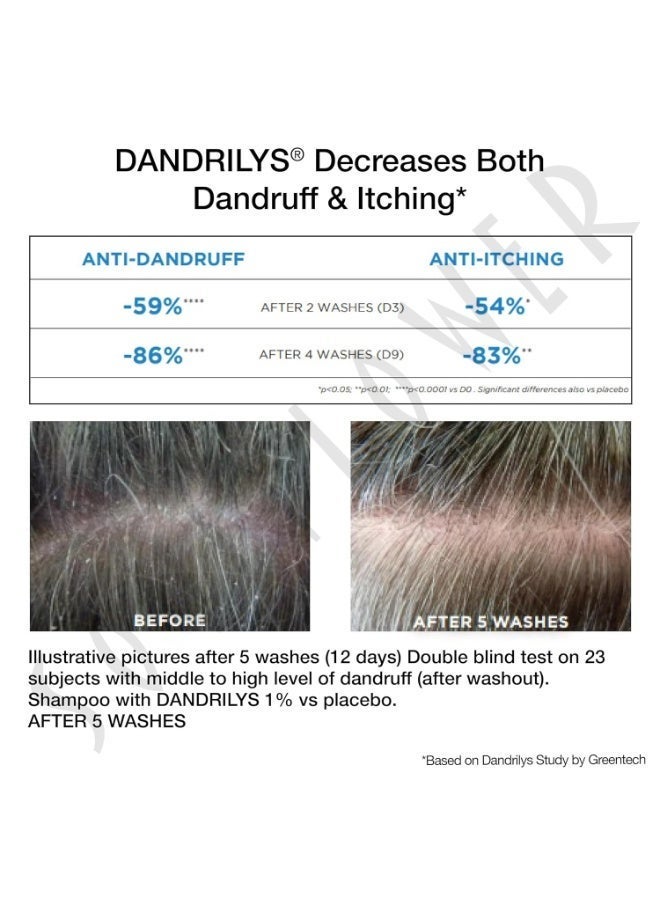 Soulflower Anti Dandruff Shampoo with Piroctone Olamine, 1% Salicylic Acid, Dandrilys -86% Dandruff Reduction in 4 washes* for Hair Growth, Hair Fall Control, Controls Itchy scalp Men & Women, 100ml - Image 5